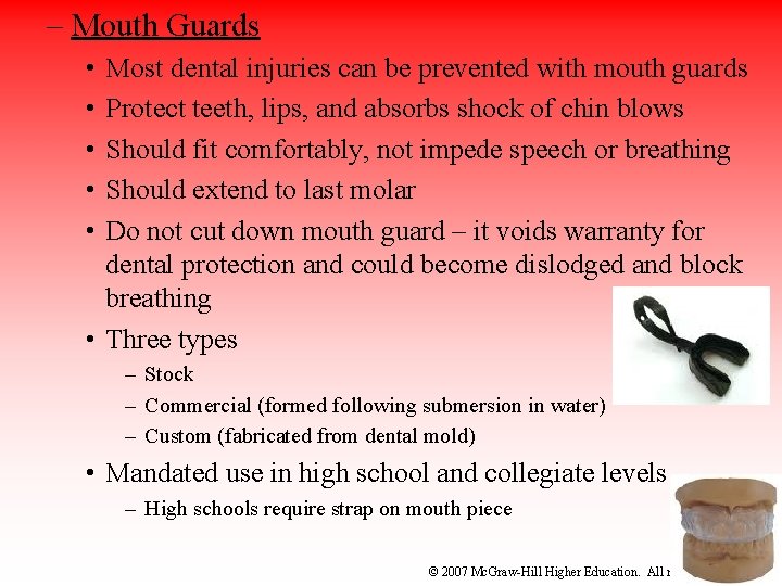 – Mouth Guards • • • Most dental injuries can be prevented with mouth