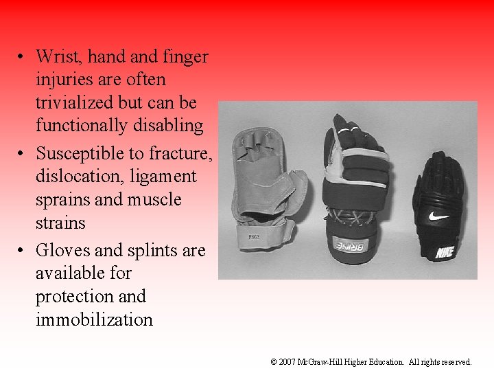 • Wrist, hand finger injuries are often trivialized but can be functionally disabling