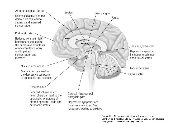 Figure 9. 1 Neuroanatomical circuit of depression. Lambert and Kinsley: Clinical Neuroscience, Second Edition Figure 9. 1 Neuroanatomical circuit of depression. Lambert and Kinsley: Clinical Neuroscience, Second Edition