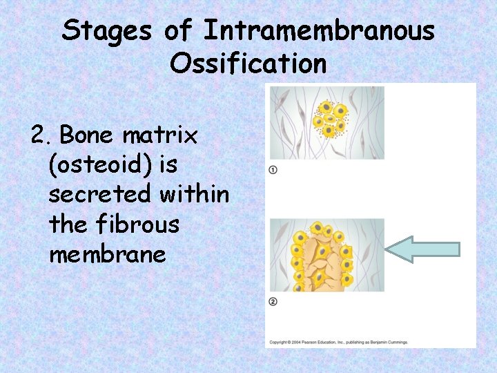 Stages of Intramembranous Ossification 2. Bone matrix (osteoid) is secreted within the fibrous membrane