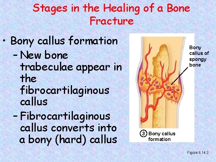 Stages in the Healing of a Bone Fracture • Bony callus formation – New