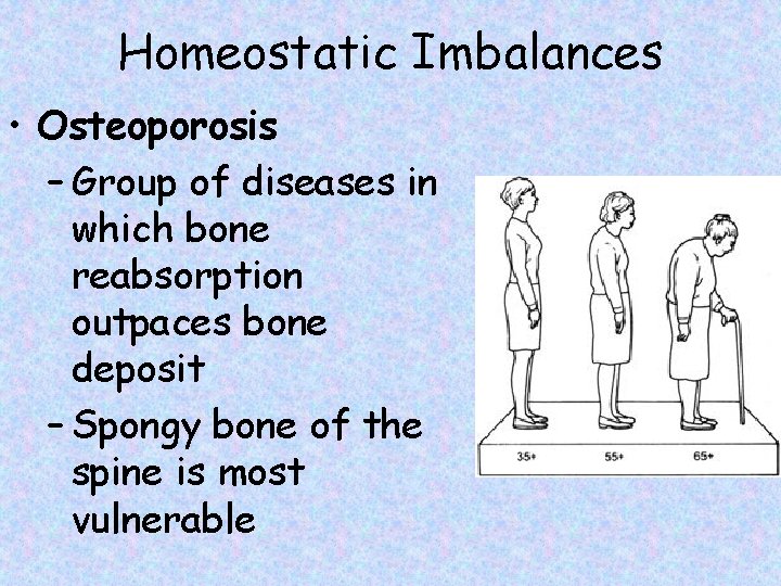 Homeostatic Imbalances • Osteoporosis – Group of diseases in which bone reabsorption outpaces bone