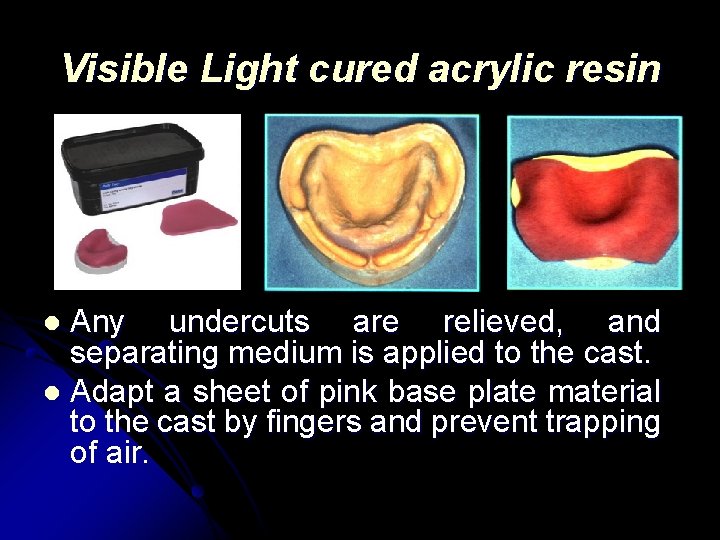 Visible Light cured acrylic resin Any undercuts are relieved, and separating medium is applied