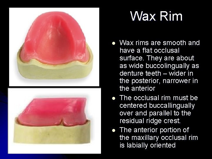 Wax Rim l l l Wax rims are smooth and have a flat occlusal