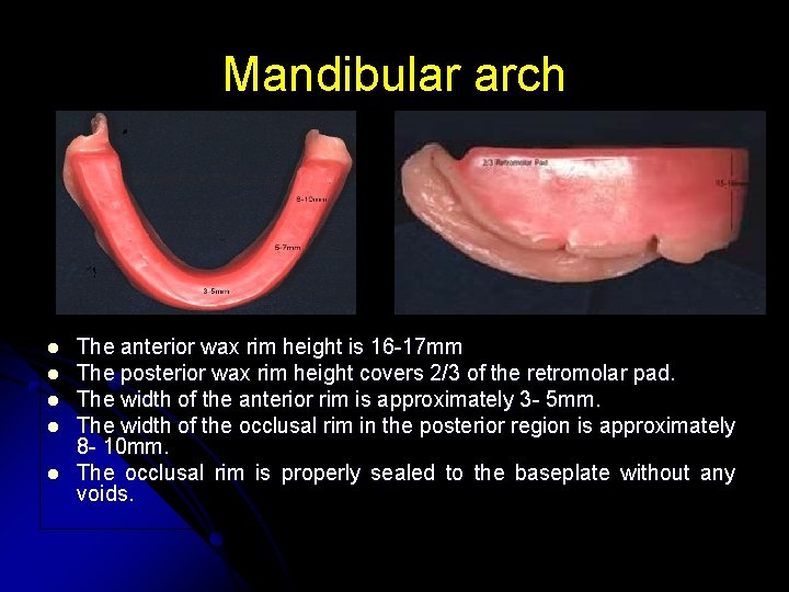 Mandibular arch l l l The anterior wax rim height is 16 -17 mm