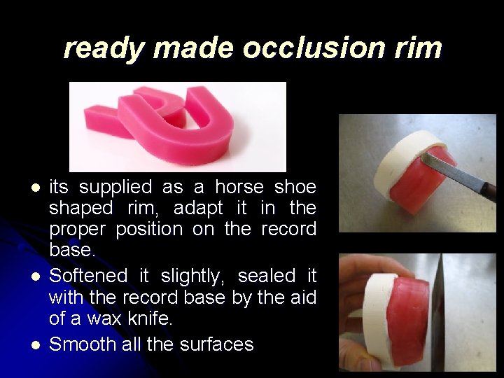 ready made occlusion rim l l l its supplied as a horse shoe shaped