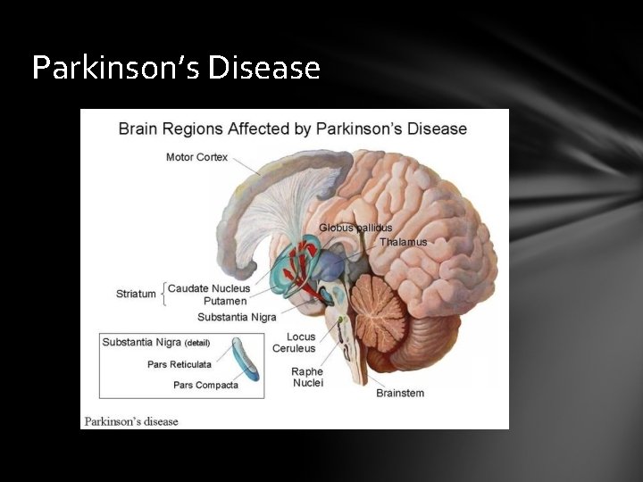 Parkinson’s Disease 