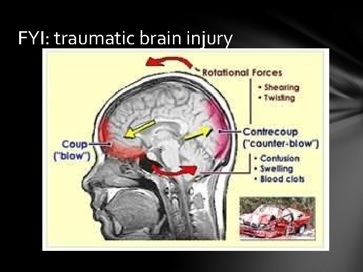 FYI: traumatic brain injury 