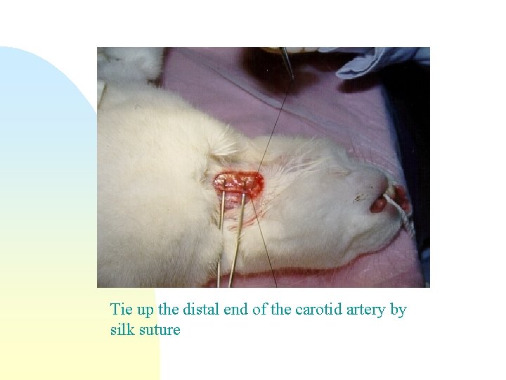 Tie up the distal end of the carotid artery by silk suture 