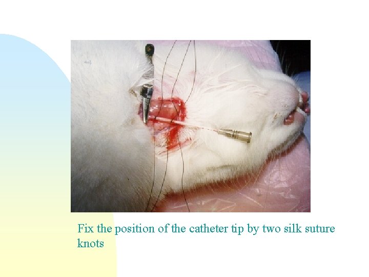 Fix the position of the catheter tip by two silk suture knots 