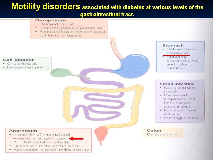 Motility disorders associated with diabetes at various levels of the gastrointestinal tract. 