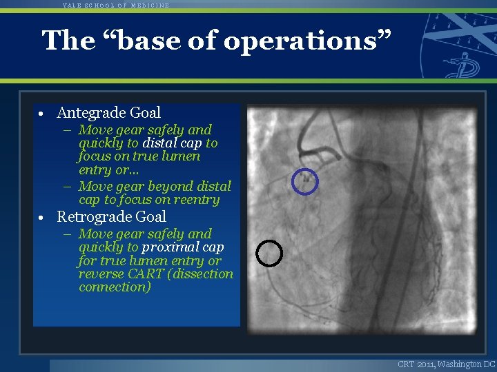 YALE SCHOOL OF MEDICINE The “base of operations” • Antegrade Goal – Move gear
