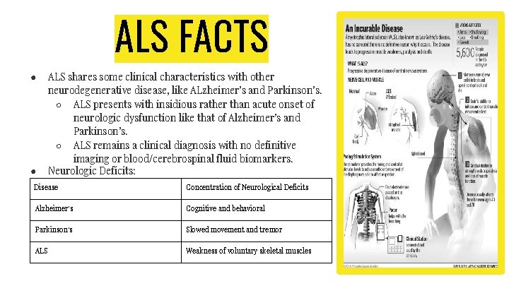 ALS FACTS ● ● ALS shares some clinical characteristics with other neurodegenerative disease, like