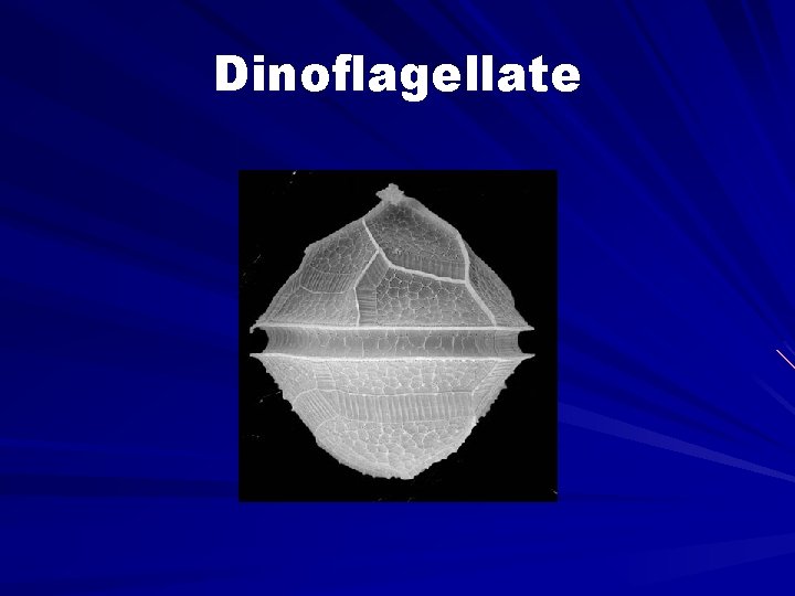 Dinoflagellate 
