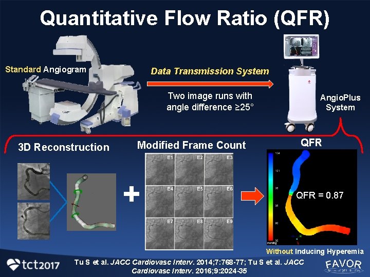 Quantitative Flow Ratio (QFR) Standard Angiogram Data Transmission System Two image runs with angle