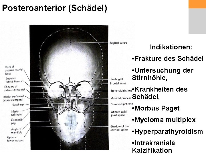 Posteroanterior (Schädel) Indikationen: • Frakture des Schädel • Untersuchung der Stirnhöhle, • Krankheiten des