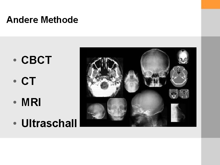 Andere Methode • CBCT • MRI • Ultraschall 