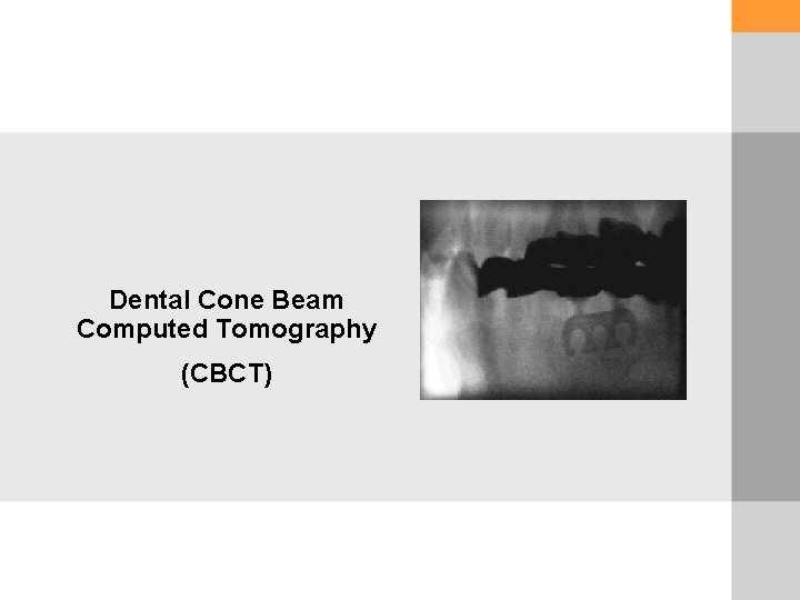 Dental Cone Beam Computed Tomography (CBCT) 