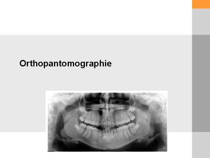 Orthopantomographie 