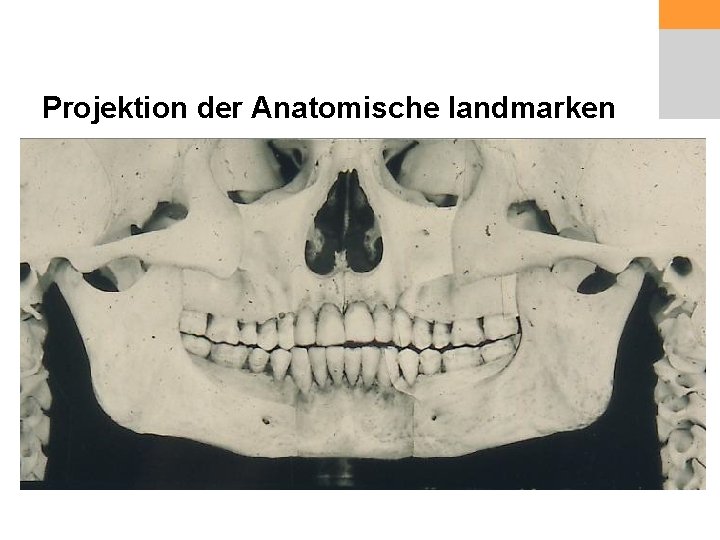 Projektion der Anatomische landmarken 