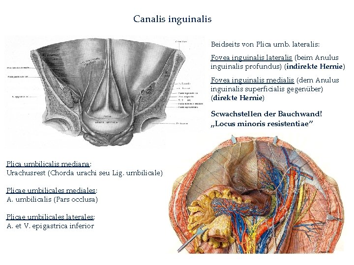 Canalis inguinalis Beidseits von Plica umb. lateralis: Fovea inguinalis lateralis (beim Anulus inguinalis profundus)