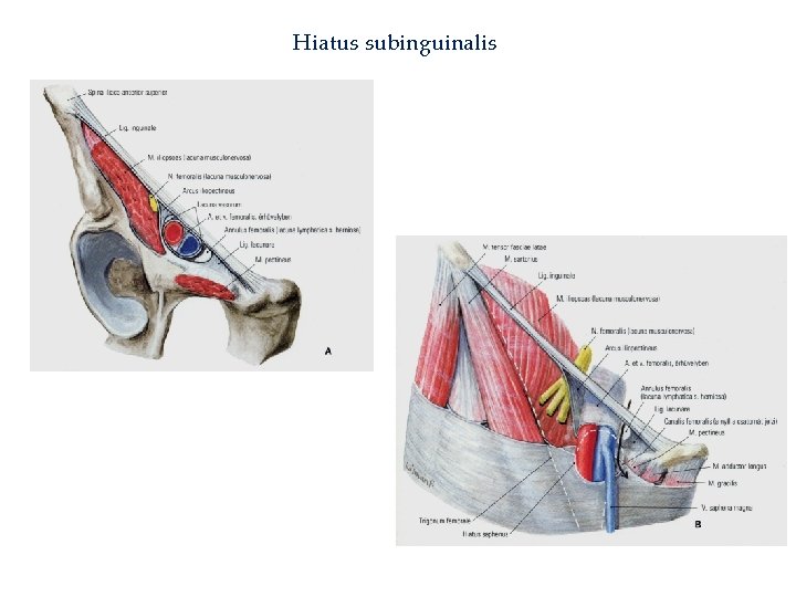 Hiatus subinguinalis 