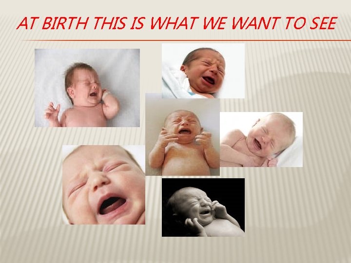 AT BIRTH THIS IS WHAT WE WANT TO SEE 