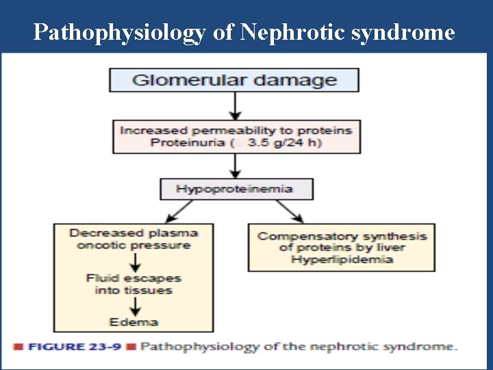 Pathophysiology of Nephrotic syndrome 