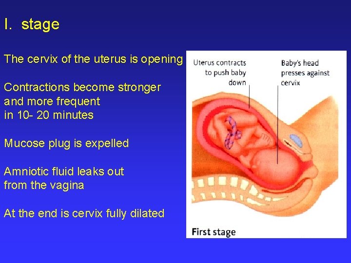 I. stage The cervix of the uterus is opening Contractions become stronger and more
