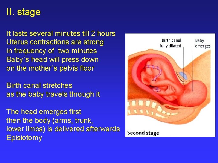 II. stage It lasts several minutes till 2 hours Uterus contractions are strong in