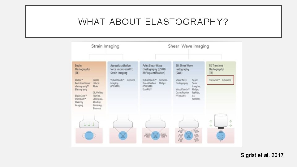 WHAT ABOUT ELASTOGRAPHY? Sigrist et al. 2017 