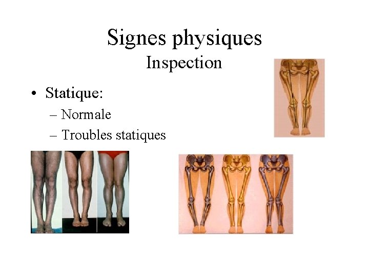 Signes physiques Inspection • Statique: – Normale – Troubles statiques 
