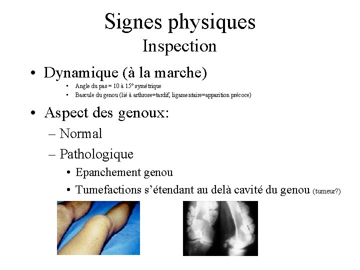 Signes physiques Inspection • Dynamique (à la marche) • • Angle du pas =