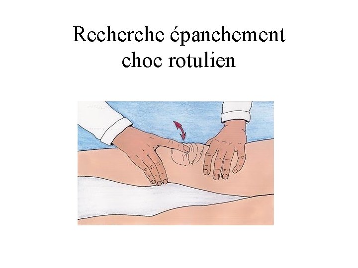 Recherche épanchement choc rotulien 