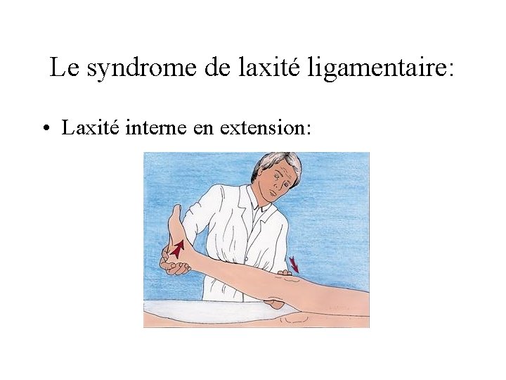 Le syndrome de laxité ligamentaire: • Laxité interne en extension: 