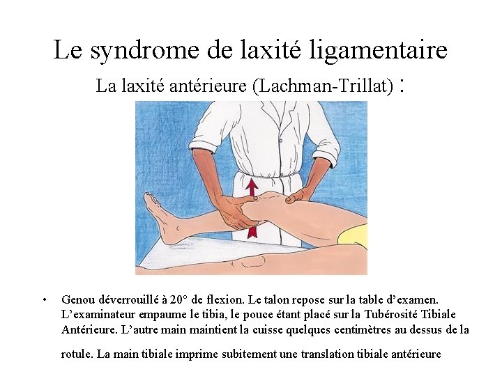 Le syndrome de laxité ligamentaire La laxité antérieure (Lachman-Trillat) : • Genou déverrouillé à