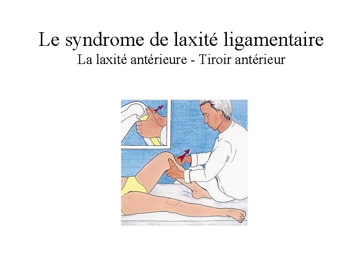 Le syndrome de laxité ligamentaire La laxité antérieure - Tiroir antérieur 