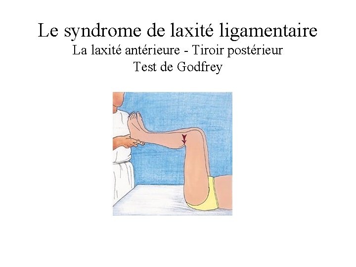 Le syndrome de laxité ligamentaire La laxité antérieure - Tiroir postérieur Test de Godfrey