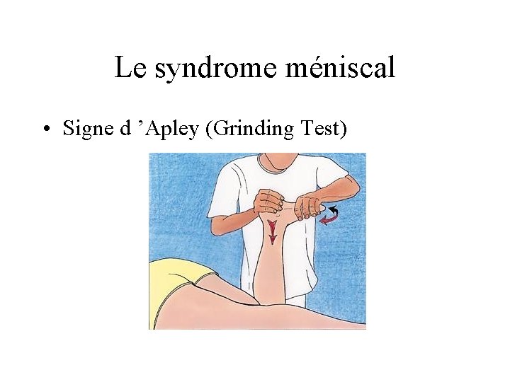 Le syndrome méniscal • Signe d ’Apley (Grinding Test) 