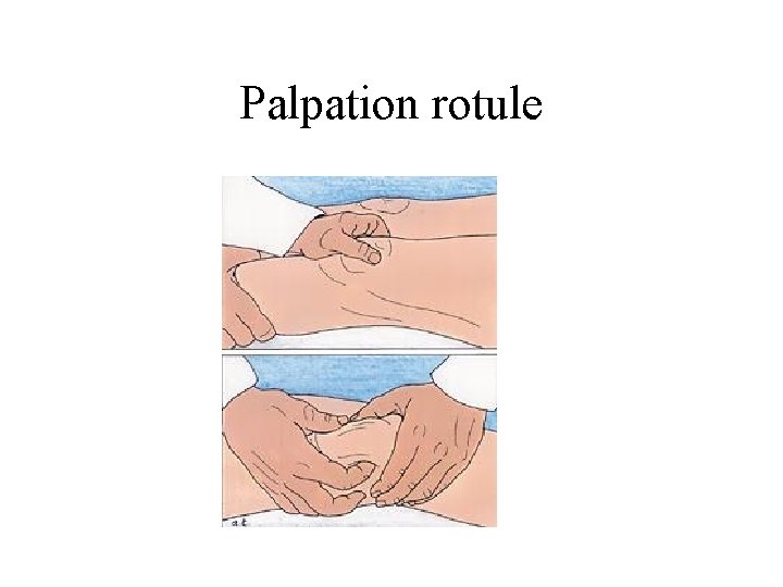 Palpation rotule 