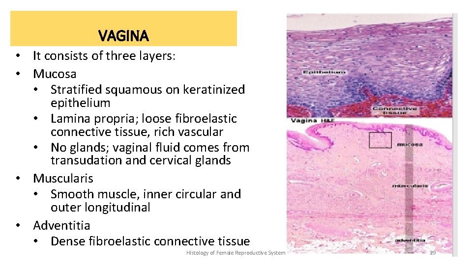 VAGINA • It consists of three layers: • Mucosa • Stratified squamous on keratinized