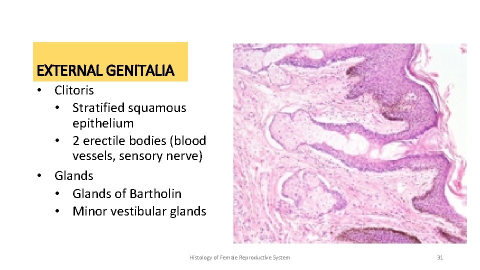 EXTERNAL GENITALIA • Clitoris • Stratified squamous epithelium • 2 erectile bodies (blood vessels,