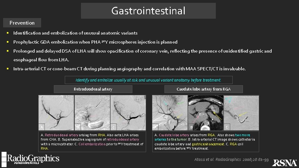 Gastrointestinal Prevention § Identification and embolization of unusual anatomic variants § Prophylactic GDA embolization
