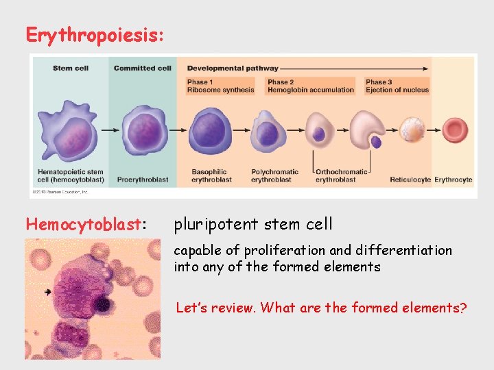 Erythropoiesis: Hemocytoblast: pluripotent stem cell capable of proliferation and differentiation into any of the