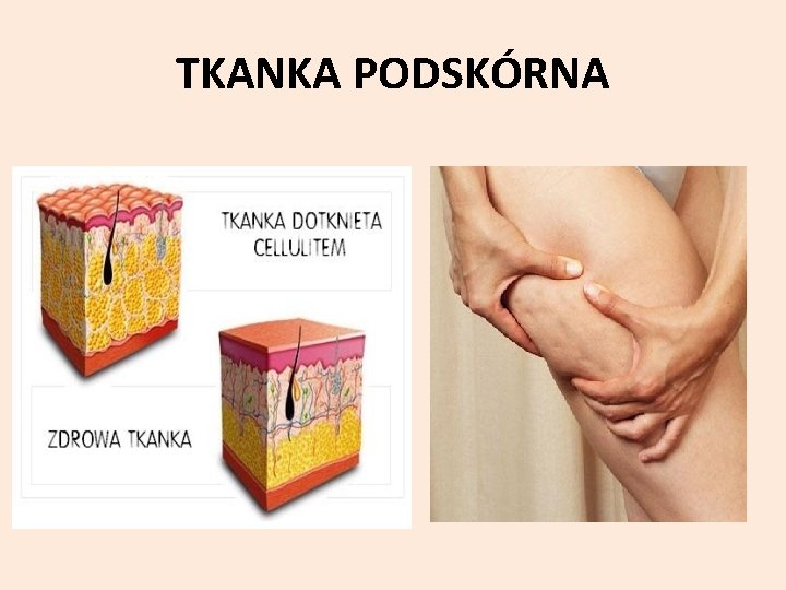 TKANKA PODSKÓRNA 