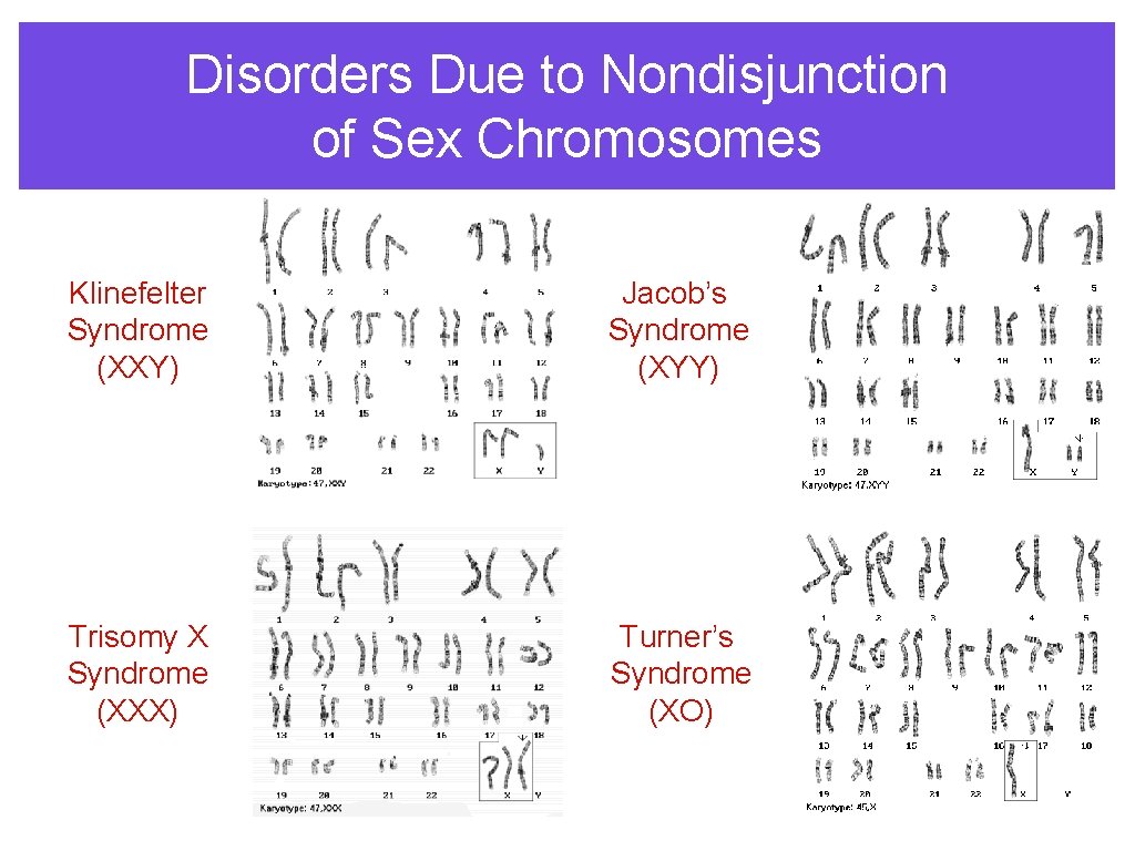 Disorders Due to Nondisjunction of Sex Chromosomes Klinefelter Syndrome (XXY) Jacob’s Syndrome (XYY) Trisomy