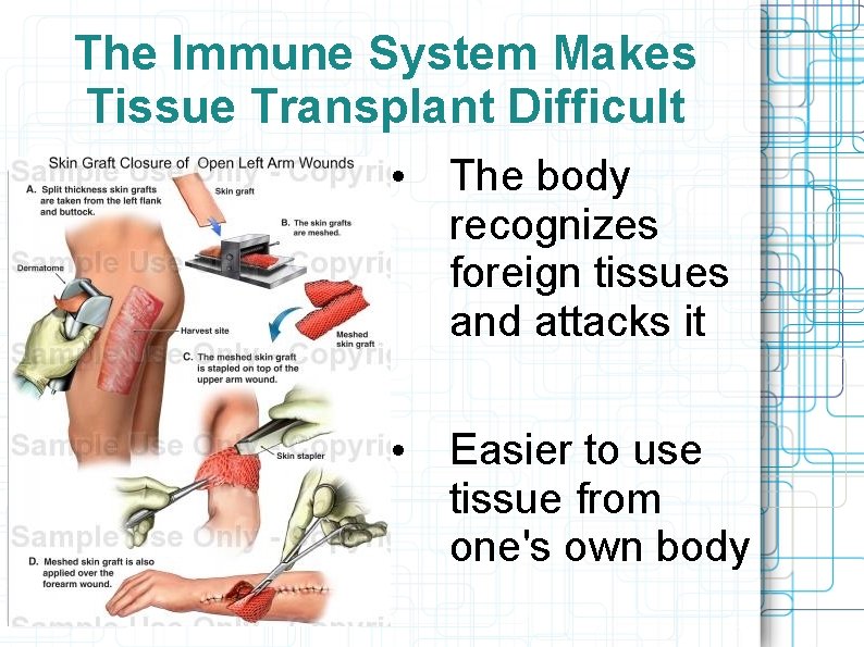 The Immune System Makes Tissue Transplant Difficult • The body recognizes foreign tissues and