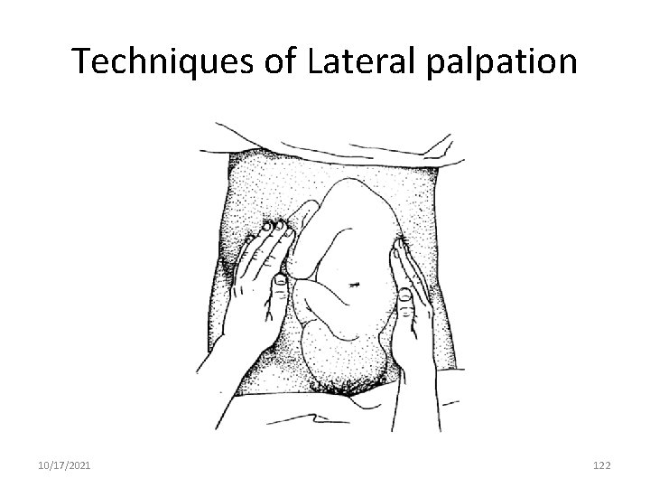 Techniques of Lateral palpation 10/17/2021 122 