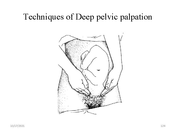 Techniques of Deep pelvic palpation 10/17/2021 124 