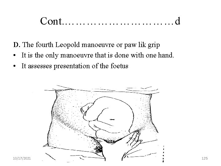 Cont. ……………d D. The fourth Leopold manoeuvre or paw lik grip • It is